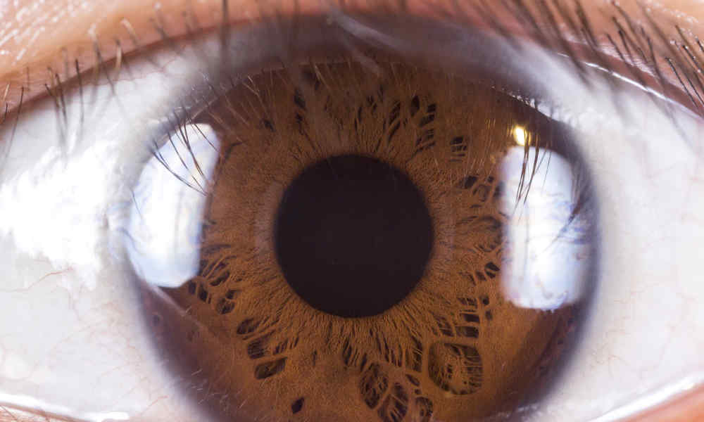 One Brown Eye